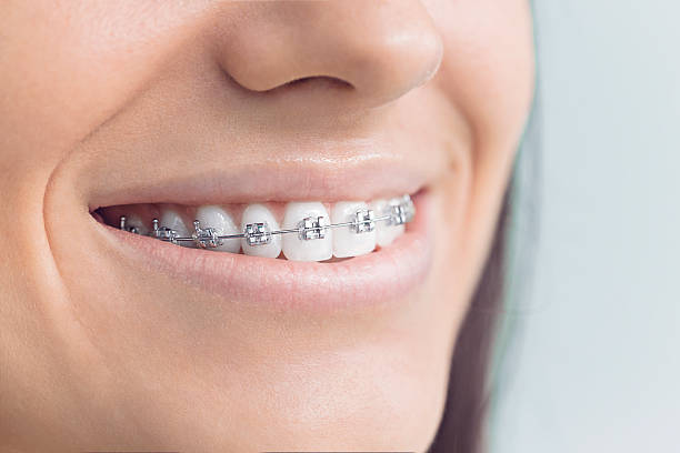 Best Veneers and Lumineers  in Mechanicstown, NY